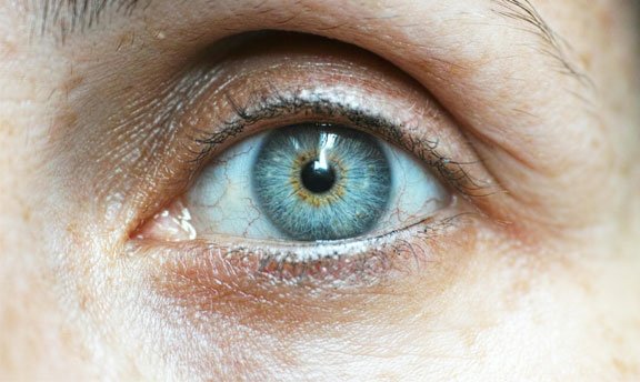 Under-Eye Circles: What’s Really Causing Them — and What Actually Works Under-Eye Circles: What's Really Causing Them — and What Actually Works